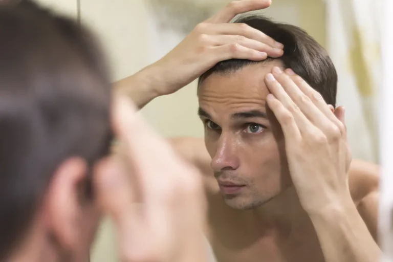 Finasteride Benefits and Uses | Hair Loss & BPH Treatment