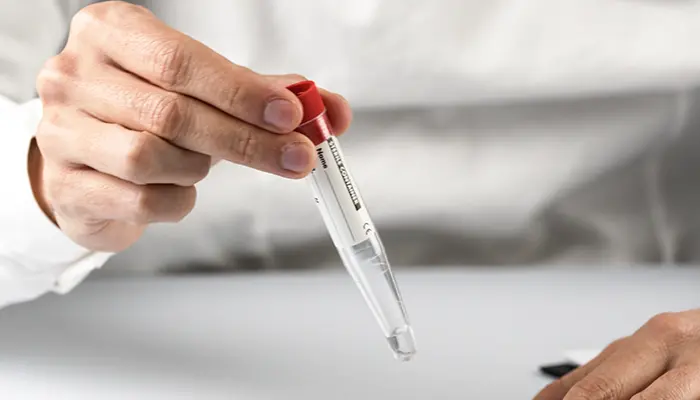Doctor holding a medical test